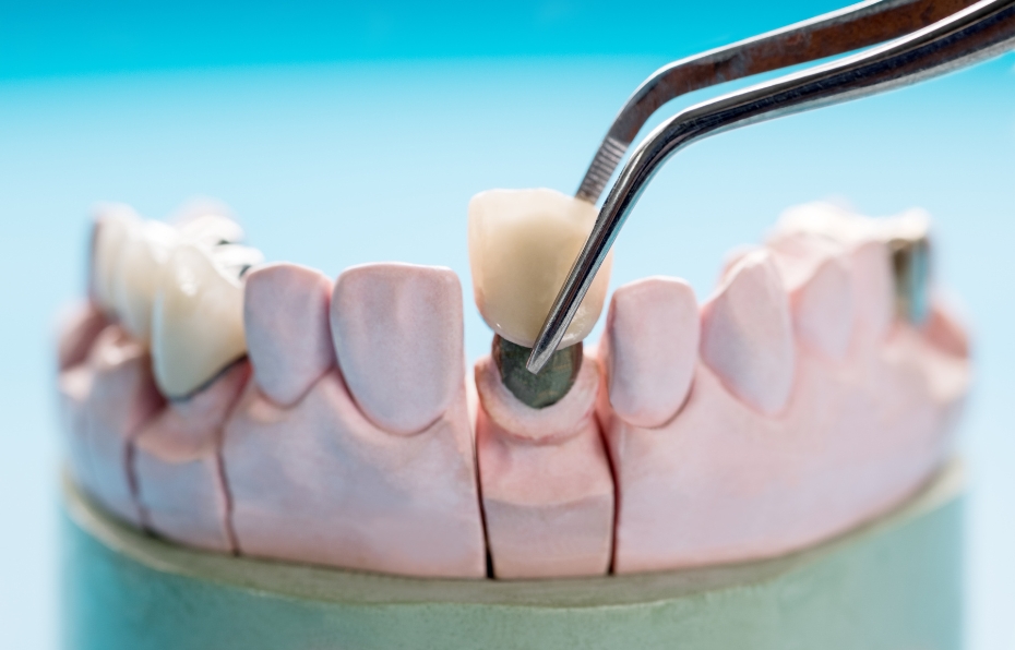 Prosthodontics Image